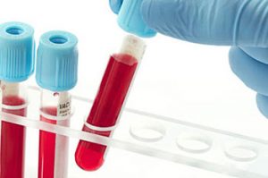 blood detox for drug users
